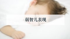 弱智儿表现