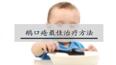 鹅口疮最佳治疗方法